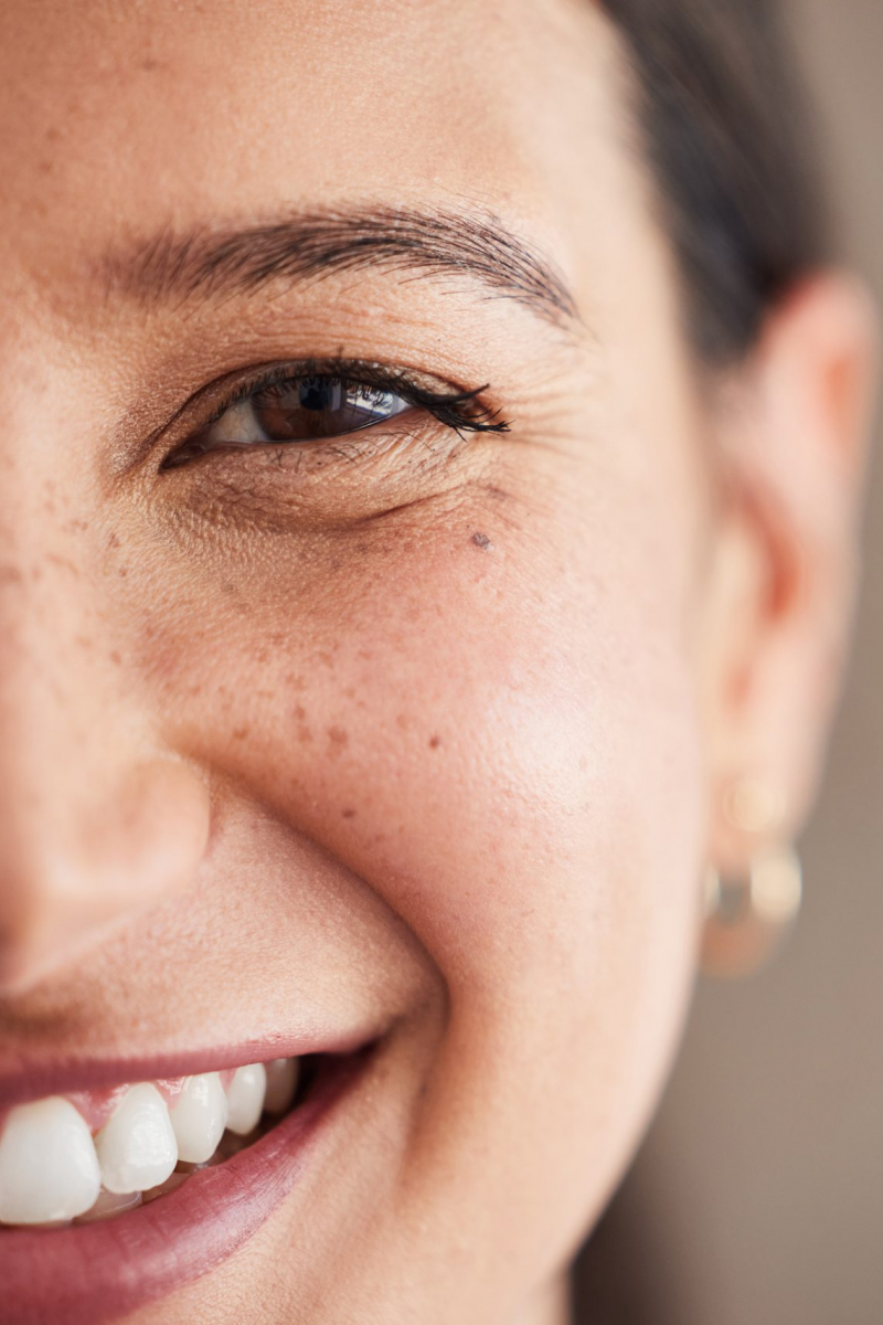 Face Of Beautiful Mixed Race Woman Smiling With White Teeth. Portrait Of A Woman's Face With Brown Eyes And Freckles Posing With Copy Space. Dental Health And Oral Hygiene